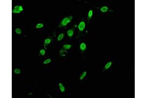 Immunofluorescence staining of Hela cells with ABIN7155093 at 1:166, counter-stained with DAPI. (HNRNPAB Antikörper  (AA 1-68))