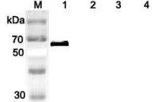 Western blot analysis of human DLL1 using anti-DLL1 (human), pAb  at 1:2,000 dilution. (DLL1 Antikörper)