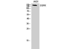 Western Blotting (WB) image for anti-Epidermal Growth Factor Receptor (EGFR) (Ser323) antibody (ABIN6280951)