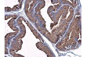 Immunohistochemistry (IHC) image for anti-Plasminogen (PLG) antibody (ABIN2855505)