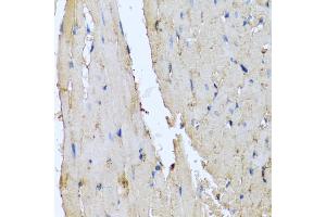 Immunohistochemistry of paraffin-embedded rat heart using DEFA1 antibody (ABIN5974152) at dilution of 1/100 (40x lens). (alpha Defensin 1 Antikörper)