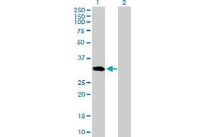 Western Blot analysis of UNC84A expression in transfected 293T cell line by UNC84A MaxPab polyclonal antibody. (SUN1 Antikörper  (AA 1-257))
