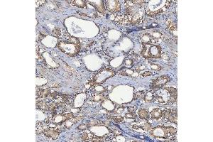 IHC analysis of SEC23IP using anti-SEC23IP antibody (ABIN7601222). (SEC23IP Antikörper  (AA 30-426))