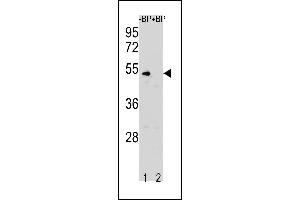 Western blot analysis of CCNB1 Antibody (N-term S9) Pab (ABIN1881151 and ABIN2843318) pre-incubated without(lane 1) and with(lane 2) blocking peptide in K562 cell line lysate. (Cyclin B1 Antikörper  (N-Term))