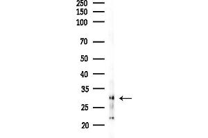 anti-Mitochondrial Ribosomal Protein L2 (MRPL2) (C-Term) antibody