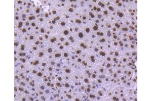 Paraformaldehyde-fixed, paraffin embedded human pancreas tissue, Antigen retrieval by boiling in sodium citrate buffer (pH6) for 15min, Block endogenous peroxidase by 3% hydrogen peroxide for 30 minutes, Blocking buffer (normal serum) at 37°C for 20min, Antibody incubation with Histone H1. (Histone H1 Antikörper)