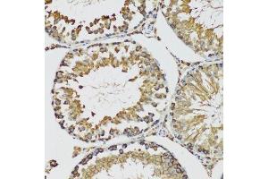 Immunohistochemistry (Paraffin-embedded Sections) (IHC (p)) image for anti-Heat Shock 70kDa Protein 9 (Mortalin) (HSPA9) (AA 380-679) antibody (ABIN3021000)