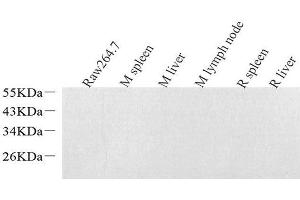 Western Blot analysis of various samples using Lysozyme Polyclonal Antibodyat dilution of 1:1000. (LYZ Antikörper)