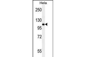 ANDR Antibody (Sumo-site) (ABIN389077 and ABIN2850530) western blot analysis in Hela cell line lysates (35 μg/lane). (Androgen Receptor Antikörper  (AA 365-392))