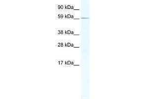 WB Suggested Anti-RBM14 Antibody Titration:  1. (RBM14 Antikörper  (N-Term))