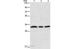 Western blot analysis of 293T and human colon cancer tissue, 231 cell, using GPA33 Polyclonal Antibody at dilution of 1:600 (GPA33 Antikörper)
