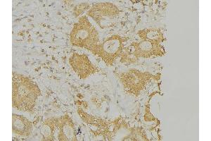 ABIN6269268 at 1/100 staining Human lung tissue by IHC-P. (PLA2G4A Antikörper  (Internal Region))
