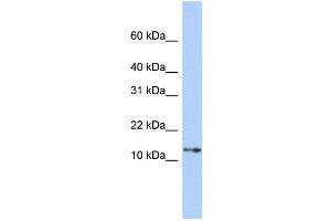 WB Suggested Anti-GNGT2 Antibody Titration: 0. (GNGT2 Antikörper  (Middle Region))