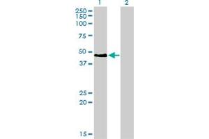 Western Blot analysis of PAX2 expression in transfected 293T cell line by PAX2 monoclonal antibody (M01), clone 3C7. (PAX2A Antikörper  (AA 194-303))