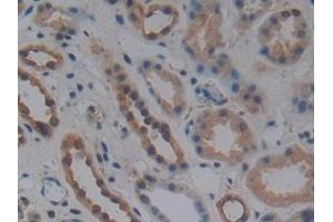 DAB staining on IHC-P; Samples: Human Kidney Tissue (WNT10B Antikörper  (AA 30-322))