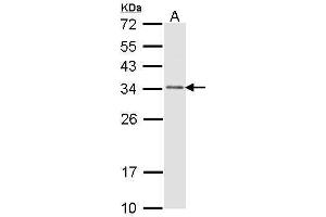 WB Image Sample (30 ug of whole cell lysate) A: H1299 12% SDS PAGE antibody diluted at 1:1000 (CAPZB Antikörper  (Center))