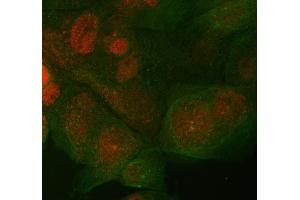 IF analysis of ST7 using anti-ST7 antibody (ABIN4886732) and anti-Beta Tubulin antibody (ABIN7602743). (ST7 Antikörper  (Middle Region))