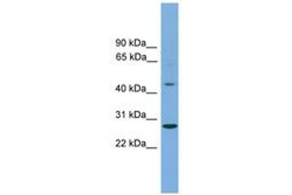 ZNF514 Antikörper  (C-Term)