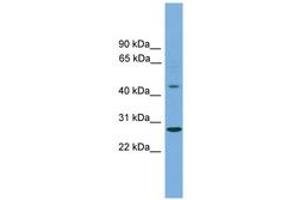 Image no. 1 for anti-Zinc Finger Protein 514 (ZNF514) (C-Term) antibody (ABIN6744688) (ZNF514 Antikörper  (C-Term))
