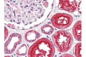 Human Kidney (formalin-fixed, paraffin-embedded) stained with ACE2at 2. (ACE2 Antikörper  (N-Term))
