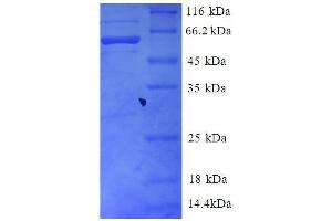 Guanine Nucleotide-Binding Protein G(I)/G(S)/G(T) (AA 21-327), (partial) protein (GST tag)