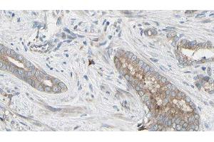 ABIN6276518 at 1/100 staining Human prostate tissue by IHC-P.