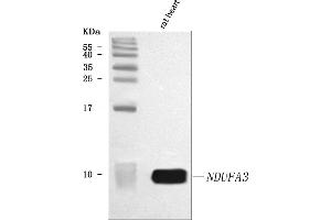 Western blot analysis of NDUFA3 using anti-NDUFA3 antibody (ABIN7599559).