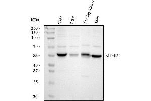 Western blot analysis of ALDH1A2 using anti-ALDH1A2 antibody (ABIN4886449).