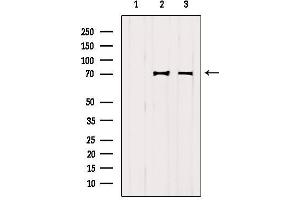 Western blot analysis of extracts from various samples, using VISA Antibody.