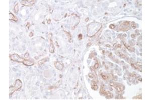 Image no. 1 for anti-Complement Component 3 (C3) antibody (ABIN951636) (C3 Antikörper)