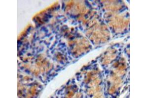 IHC-P analysis of Bowels tissue, with DAB staining. (TPSD1 Antikörper  (AA 99-191))