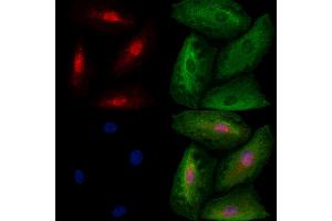ABIN6259602 and ABIN6273527 staining  cells by IF/ICC. (TBR1 Antikörper  (N-Term))
