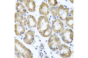 Immunohistochemistry of paraffin-embedded human stomach using M6PR antibody. (M6PR Antikörper)