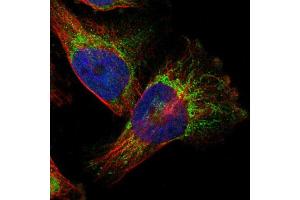 Immunofluorescent staining of U251 cells using TAOK3 polyclonal antibody  shows positivity in mitochondria (green). (TAO Kinase 3 Antikörper  (AA 323-432))