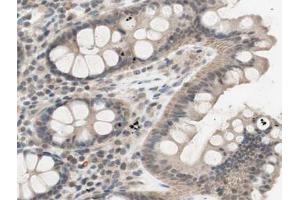 Immunohistochemistry (IHC) image for anti-conserved Helix-Loop-Helix Ubiquitous Kinase (CHUK) (pThr23) antibody (ABIN6255637)
