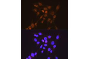 Immunofluorescence analysis of NIH-3T3 cells using [KO Validated] Smad2 Rabbit mAb (ABIN7270344) at dilution of 1:100 (40x lens). (SMAD2 Antikörper)