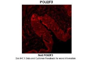 Sample Type :  Mouse tongue tissue  Primary Antibody Dilution :  1:100  Secondary Antibody :  Anti-rabbit-Cy3  Secondary Antibody Dilution :  1:500  Color/Signal Descriptions :  Red: POU2F3  Gene Name :  POU2F3  Submitted by :  Dr. (POU2F3 Antikörper  (N-Term))