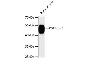 Western blot analysis of extracts of rat pancreas, using PNLIPRP2 antibody (ABIN6130643, ABIN6145842, ABIN6145843 and ABIN6216695) at 1:3000 dilution.