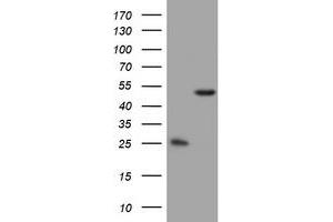 Image no. 4 for anti-3-Oxoacyl-ACP Synthase, Mitochondrial (OXSM) (AA 78-343) antibody (ABIN1491676) (OXSM Antikörper  (AA 78-343))