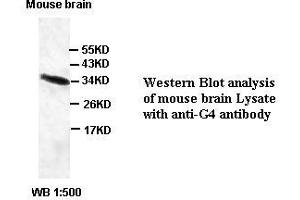 Image no. 1 for anti-Chromosome 6 Open Reading Frame 47 (C6ORF47) antibody (ABIN791190) (C6orf47 Antikörper)