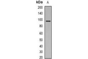 Western blot analysis of Glucocorticoid Receptor expression in Jurkat (A) whole cell lysates. (Glucocorticoid Receptor Antikörper)