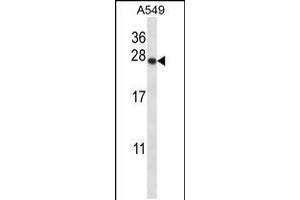Western blot analysis in A549 cell line lysates (35ug/lane).
