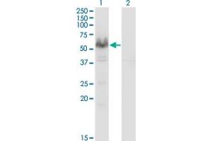 Western Blot analysis of PPP3CA expression in transfected 293T cell line by PPP3CA monoclonal antibody (M03), clone 2G8. (PPP3CA Antikörper  (AA 1-84))