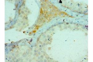 Immunohistochemistry of paraffin-embedded human testis tissue using ABIN7172781 at dilution of 1:100