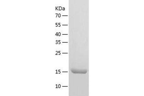 COPZ1 Protein (AA 1-177) (His tag)