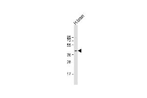 Anti-PRKACB Antibody (K29) at 1:1000 dilution + human brain lysate Lysates/proteins at 20 μg per lane.
