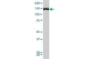 Viral Entry Inhibition (VEI) image for anti-Tripartite Motif Containing 33 (TRIM33) (AA 1006-1106) antibody (ABIN599250) (TRIM33 Antikörper  (AA 1006-1106))