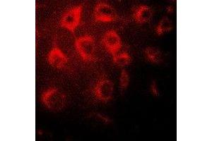 Immunofluorescent analysis of Wilms Tumor 1 staining in MCF7 cells. (WT1 Antikörper)