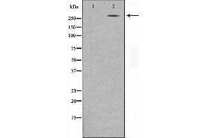 Western blot analysis on MDA-MB-435 cell lysate using NCoR1 Antibody,The lane on the left is treated with the antigen-specific peptide. (NCOR1 Antikörper  (N-Term))