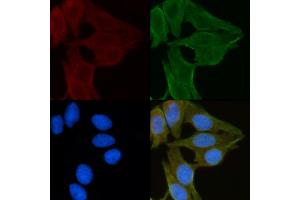ABIN6260054 and ABIN6272249 staining Hela cells(30 min of UV treatment) by IF/ICC. (ARRDC1 Antikörper  (C-Term))